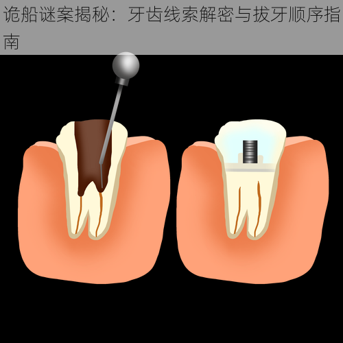 诡船谜案揭秘：牙齿线索解密与拔牙顺序指南